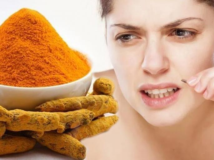 How to use turmeric to remove facial hair | चेहऱ्यावरील नको असलेले केस हळदीच्या मदतीने दूर करा, कसे ते वाचा! How to use turmeric to remove facial hair | चेहऱ्यावरील नको असलेले केस हळदीच्या मदतीने दूर करा, कसे ते वाचा!