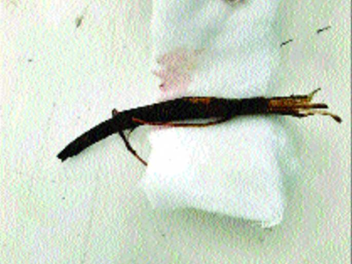 Success in removing a nine cm intravenous rod in the throat | गळ्यात नऊ सेंमीची घुसलेली काडी काढण्यात यश Success in removing a nine cm intravenous rod in the throat | गळ्यात नऊ सेंमीची घुसलेली काडी काढण्यात यश