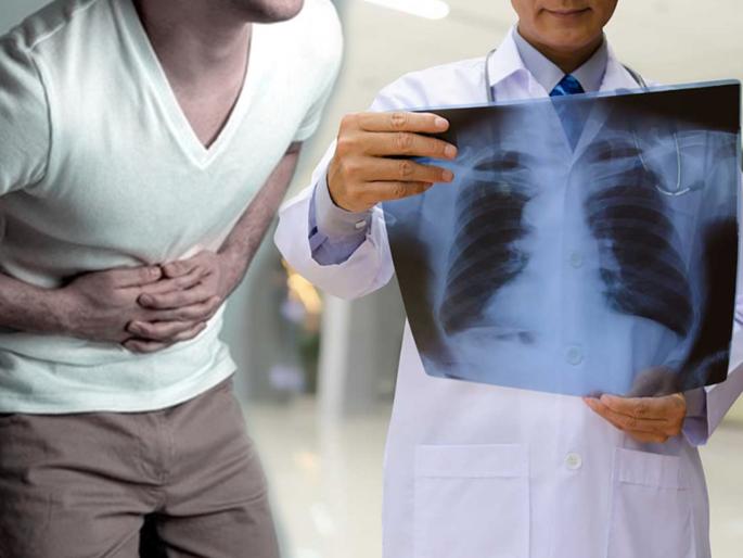 Man was born with all his organs on wrong side | पोटात दुखत होतं म्हणून डॉक्टरकडे गेला, रिपोर्ट पाहिला तर पोटात सगळंच उलटं-सुलटं! Man was born with all his organs on wrong side | पोटात दुखत होतं म्हणून डॉक्टरकडे गेला, रिपोर्ट पाहिला तर पोटात सगळंच उलटं-सुलटं!