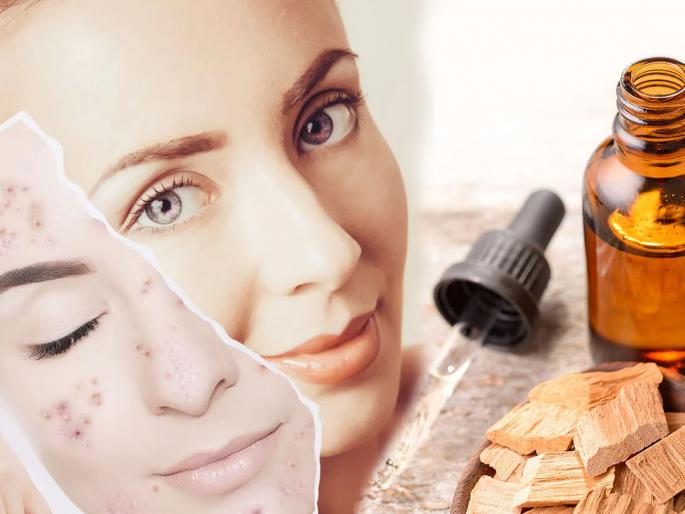 Sandalwood oil and powder beauty benefits | सुंदर त्वचेसाठी सर्वात बेस्ट आयुर्वेदिक उपाय चंदनाचं तेल, याचे फायदे वाचाल तर सर्व ब्युटी प्रॉडक्ट्स वापरणं सोडाल! Sandalwood oil and powder beauty benefits | सुंदर त्वचेसाठी सर्वात बेस्ट आयुर्वेदिक उपाय चंदनाचं तेल, याचे फायदे वाचाल तर सर्व ब्युटी प्रॉडक्ट्स वापरणं सोडाल!
