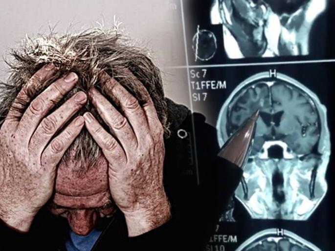 Worm lived in mans brain for 30 years causing headaches and seizures in China | फिट्स येतात म्हणून 30 वर्षं घेत होता औषध, सत्य कळताच सगळेच चक्रावले! Worm lived in mans brain for 30 years causing headaches and seizures in China | फिट्स येतात म्हणून 30 वर्षं घेत होता औषध, सत्य कळताच सगळेच चक्रावले!