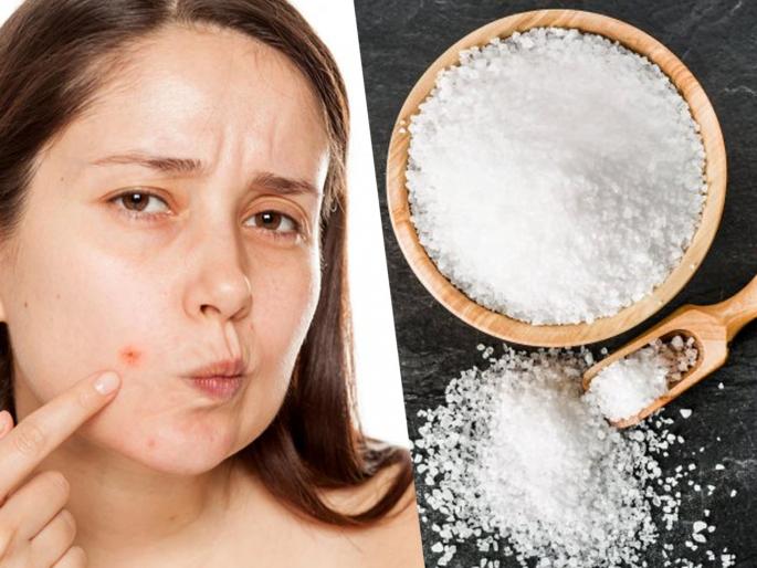 Know how salt water cleanses skin | त्वचेच्या वेगवेगळ्या समस्या दूर करण्यासाठी मिठाचं पाणी वापराल, तर महागडे प्रॉडक्ट्स विसराल.... Know how salt water cleanses skin | त्वचेच्या वेगवेगळ्या समस्या दूर करण्यासाठी मिठाचं पाणी वापराल, तर महागडे प्रॉडक्ट्स विसराल....