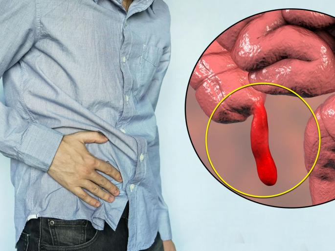 Know the symptoms and cure from appendicitis | पोटात उजवीकडे दुखत असेल तर असू शकतो 'या' गंभीर समस्येचा संकेत, सर्जरीशिवाय नाही पर्याय! Know the symptoms and cure from appendicitis | पोटात उजवीकडे दुखत असेल तर असू शकतो 'या' गंभीर समस्येचा संकेत, सर्जरीशिवाय नाही पर्याय!