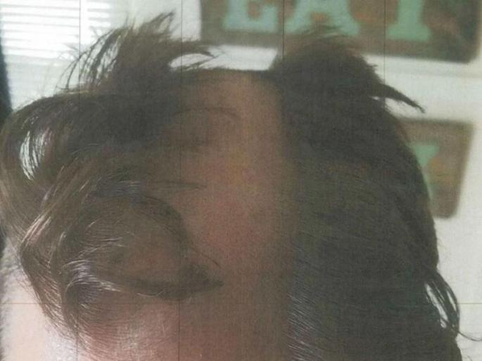 #SHOCKING: Hair styller cut off customer's ears in us | #SHOCKING : केस कापायला गेलेल्या ग्राहकाचा स्टायलिस्टने चक्क कापला कान #SHOCKING: Hair styller cut off customer's ears in us | #SHOCKING : केस कापायला गेलेल्या ग्राहकाचा स्टायलिस्टने चक्क कापला कान