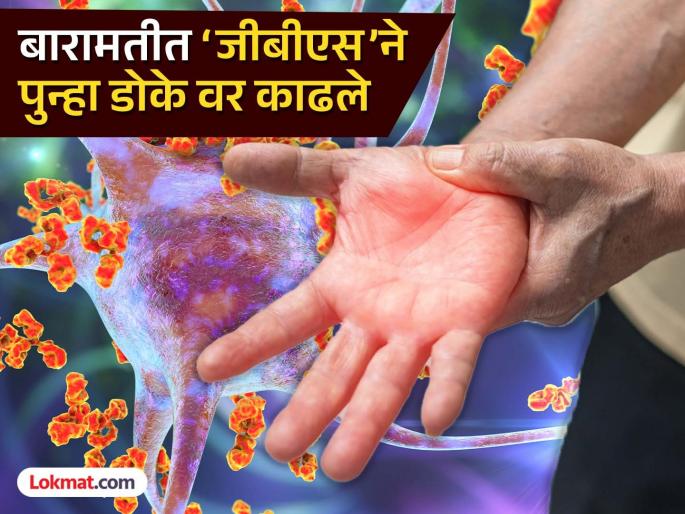 GBS rears its again in Baramati 15-year-old youth in the city infected | GBS Virus: बारामतीत ‘जीबीएस’ने पुन्हा डोके वर काढले; शहरातील १५ वर्षीय युवकास लागण GBS rears its again in Baramati 15-year-old youth in the city infected | GBS Virus: बारामतीत ‘जीबीएस’ने पुन्हा डोके वर काढले; शहरातील १५ वर्षीय युवकास लागण