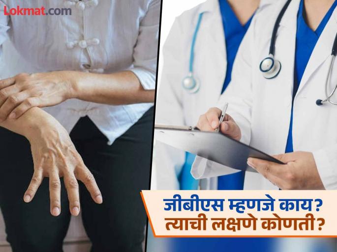 Guidelines issued regarding GBS disease! Know what to do and what to avoid | GBS Disease: जीबीएस आजाराबाबत मार्गदर्शक सूचना जारी! जाणून घ्या, काय करावं अन् काय टाळावं Guidelines issued regarding GBS disease! Know what to do and what to avoid | GBS Disease: जीबीएस आजाराबाबत मार्गदर्शक सूचना जारी! जाणून घ्या, काय करावं अन् काय टाळावं