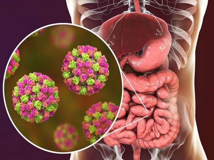 Norovirus the highly contagious virus that spreads in winters | हिवाळ्यात वेगाने पसरतो हा Norovirus, जाणून घ्या याची लक्षणे आणि कारणे! Norovirus the highly contagious virus that spreads in winters | हिवाळ्यात वेगाने पसरतो हा Norovirus, जाणून घ्या याची लक्षणे आणि कारणे!