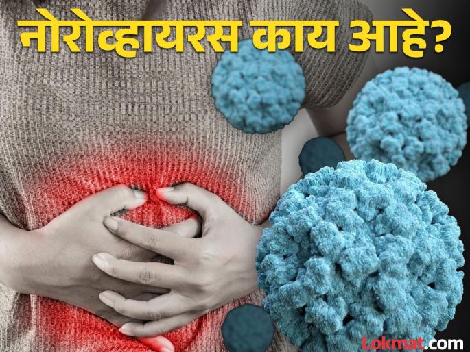 What is Norovirus, which is raising in America? Know the full details! | काय आहे नोरोव्हायरस ज्याचा अमेरिकेत वाढतोय कहर? जाणून घ्या पूर्ण डिटेल्स!