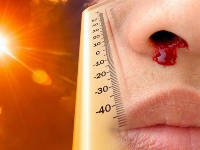 why do people suffer from nosebleed during summers; how to Prevent it | उन्हामुळे नाकातून रक्त?... घाबरू नका; करून पाहा काही घरगुती उपाय! why do people suffer from nosebleed during summers; how to Prevent it | उन्हामुळे नाकातून रक्त?... घाबरू नका; करून पाहा काही घरगुती उपाय!