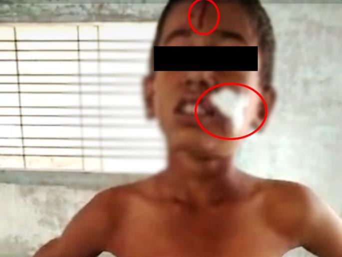 stepmother tortures minor boy in very Inhuman way in nashik | भयंकर! सावत्र आई असलेल्या मावशीचे लहानग्यावर अमानुष अत्याचार; चटके दिल्यानं चिमुरडा भाजला stepmother tortures minor boy in very Inhuman way in nashik | भयंकर! सावत्र आई असलेल्या मावशीचे लहानग्यावर अमानुष अत्याचार; चटके दिल्यानं चिमुरडा भाजला