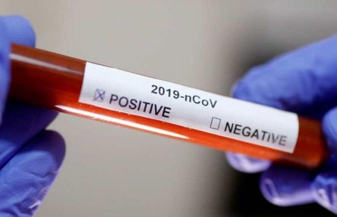 20 people of MangrulPeer in contact with a corona patient are negative | कोरोनाबाधित रुग्णाच्या संपर्कातील मंगरूळपीरचे २० जण निगेटिव्ह 20 people of MangrulPeer in contact with a corona patient are negative | कोरोनाबाधित रुग्णाच्या संपर्कातील मंगरूळपीरचे २० जण निगेटिव्ह