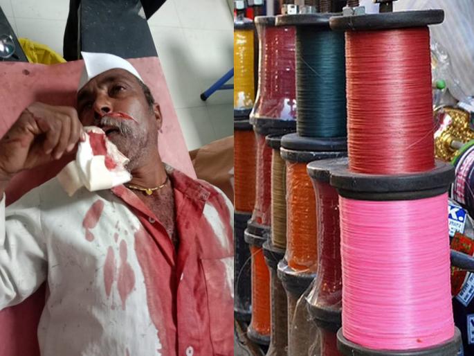 One person was seriously injured, fortunately the throat was spared as the manja got stuck and cut his cheek | मांजा अडकून गाल चिरल्याने एकजण गंभीर जखमी, सुदैवाने गळा वाचला One person was seriously injured, fortunately the throat was spared as the manja got stuck and cut his cheek | मांजा अडकून गाल चिरल्याने एकजण गंभीर जखमी, सुदैवाने गळा वाचला