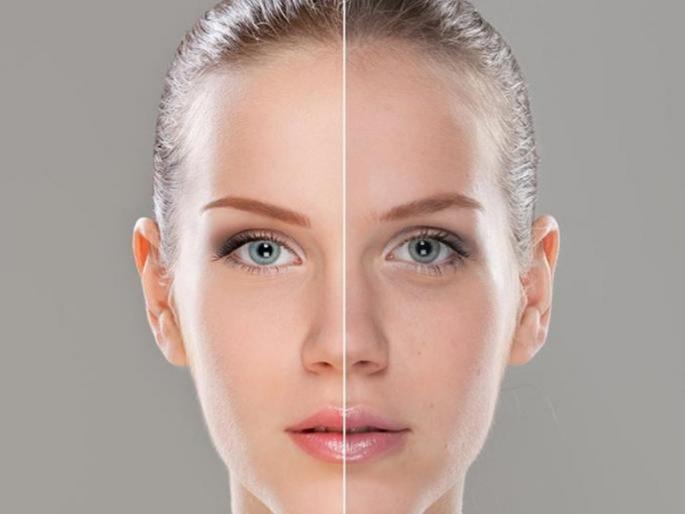 Top 3 effective home remedies for uneven skin tone and tanned skin | इव्हन टोनसोबतच, चेहऱ्यावरील डाग दूर करण्यासाठी 'हे' 3 घरगुती उपाय; एकदा वापरून पाहाच Top 3 effective home remedies for uneven skin tone and tanned skin | इव्हन टोनसोबतच, चेहऱ्यावरील डाग दूर करण्यासाठी 'हे' 3 घरगुती उपाय; एकदा वापरून पाहाच