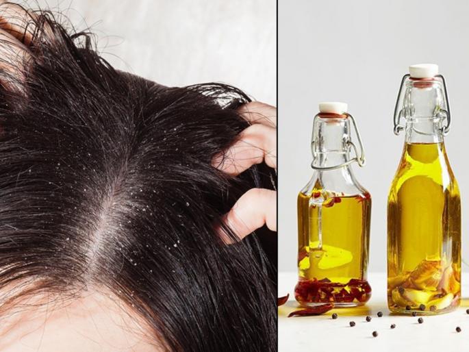 Special homemade oil for hair growth and dandruff issues | थंडीत केसांच्या सर्व समस्यांवर 'हे' घरगुती तेल ठरतं फायदेशीर Special homemade oil for hair growth and dandruff issues | थंडीत केसांच्या सर्व समस्यांवर 'हे' घरगुती तेल ठरतं फायदेशीर