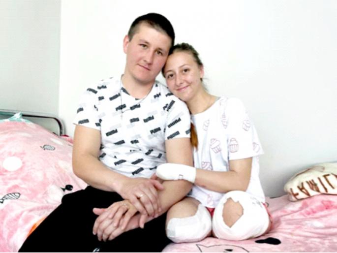 Ukrainian nurse who lost both legs in war shares first dance with husband | दोन्ही पाय गेले, तरीही स्वत:च्या लग्नात डान्स Ukrainian nurse who lost both legs in war shares first dance with husband | दोन्ही पाय गेले, तरीही स्वत:च्या लग्नात डान्स