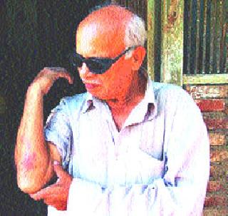 Aging Violence Crisis | वृद्ध वीजग्राहकास मारहाण