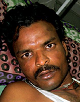 Two workers were injured by the blow of the electric current | विद्युत प्रवाहाचा झटका दोन मजूर भाजले