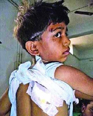 The girl is saved from the jaw jaw | बिबट्याच्या जबड्यातून मुलीला वाचविले