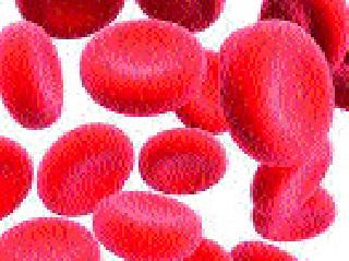 55 percent of women suffer from anemia | ५५ टक्के महिला अ‍ॅनिमियाने त्रस्त
