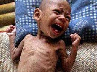 130 acute and 764 middle child malnourished | १३० तीव्र तर ७६४ मध्यम कुपोषित बालके