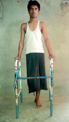 Financial support for artificial foundation | कृत्रिम पायासाठी हवे आर्थिक पाठबळ