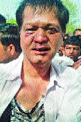 Whistle Chop | विक्षिप्ताला बेदम चोप