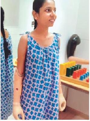 Monica typing works by artificial hand | कृत्रिम हाताने करते मोनिका टायपिंग