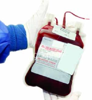 Blood has been stuck in inflation | रक्तही अडकले महागाईच्या विळख्यात