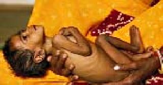 Prevention of diarrhea will prevent infanticide | बालमृत्यू रोखणार अतिसार नियंत्रण