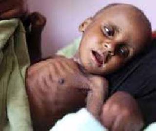 Childhood abuse in West Wahadas | पश्‍चिम वर्‍हाडात बळावतेय बालकुपोषण