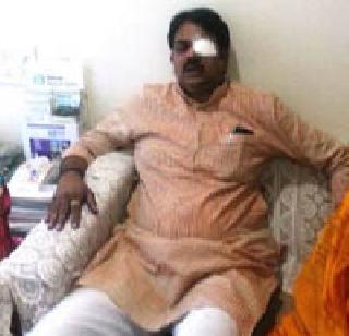 Harshavardhan Patil injured in Shihahlaya | शाईहल्ल्यात हर्षवर्धन पाटील जखमी Harshavardhan Patil injured in Shihahlaya | शाईहल्ल्यात हर्षवर्धन पाटील जखमी