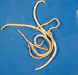 Woman worn for beauty | मुलीला सौंदर्यासाठी खाऊ घातले जंत Woman worn for beauty | मुलीला सौंदर्यासाठी खाऊ घातले जंत