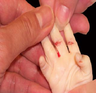 Inhuman torture for pregnancy test | गर्भलिंग तपासणीसाठी अमानुष छळ