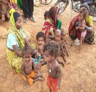 Much malnutrition in unauthorized slums | अनधिकृत झोपडपट्टीत जास्त कुपोषण