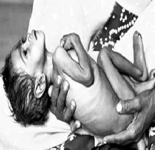 88 seats in Karjat | कर्जतमध्ये 88 अतिकुपोषित