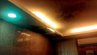 Heart Surgery That Has Lapsed From 22 Days | २२ दिवसांपासून थांबल्या हृदय शस्त्रक्रिया