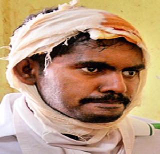 Bank officials in Mumbai: Dementia with dementia | मुंबईतील बँक अधिका:याचा आघाताने स्मृतिभ्रंश Bank officials in Mumbai: Dementia with dementia | मुंबईतील बँक अधिका:याचा आघाताने स्मृतिभ्रंश