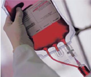 Blood cellphone shut off year after year | ब्लड मोबाईल व्हॅन वर्षभरापासून बंद