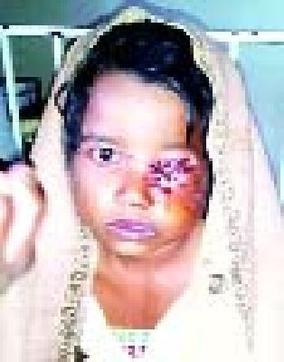 Lechi's escape from a leopard's sword | बिबट्याच्या तावडीतून केली लेकीची सुटका