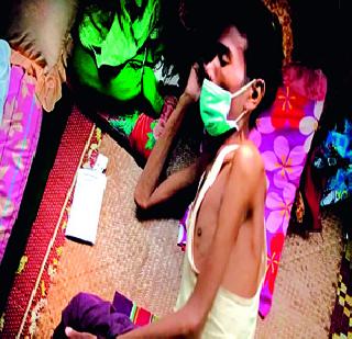 'Help' information for the treatment | हवी उपचाराच्या माहितीची ‘हेल्प’