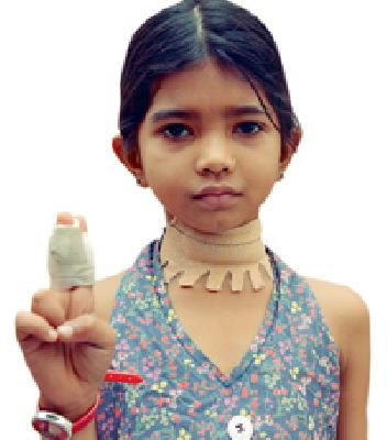 If the thread of life was broken ... | जीवनाचा धागा तुटला असता तर.. If the thread of life was broken ... | जीवनाचा धागा तुटला असता तर..