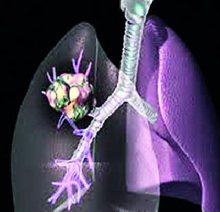 Ayurveda is desperable to achieve it | आयुर्वेदाने असाध्य ते साध्य