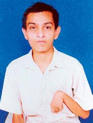 Disability, mentally challenged youth | अपंग, मतिमंद युवकाची उपचारासाठी वणवण