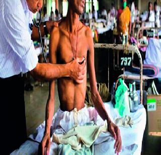 Taking the treatment of tuberculosis is harmful for others | क्षयरोगावर उपचार न घेणे इतरांसाठी घातक