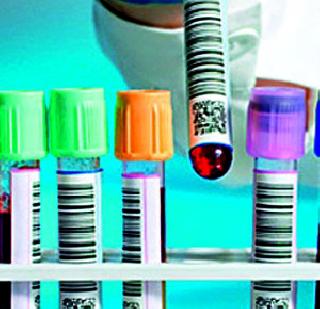 When did the bogus action against the lab? | बोगस लॅबविरुद्ध कारवाई कधी?