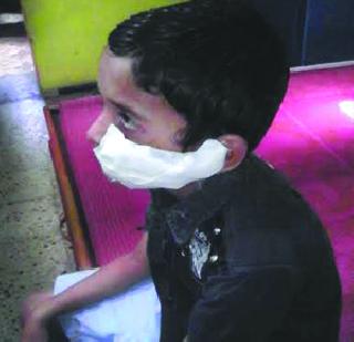 Kidney attack child critical | कुत्र्याच्या हल्ल्यात बालक गंभीर