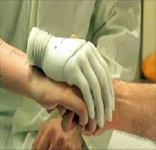 Free hand-foot distribution camp on Aurangabad Sunday | औरंगाबादेत रविवारी मोफत हात-पाय वाटप शिबिर Free hand-foot distribution camp on Aurangabad Sunday | औरंगाबादेत रविवारी मोफत हात-पाय वाटप शिबिर