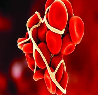 520 patients of hemophilia | हिमोफिलीयाचे ५२० रुग्ण 520 patients of hemophilia | हिमोफिलीयाचे ५२० रुग्ण