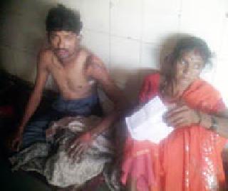 Two-hour burn injuries | दोन तास तडफडला जळीत रूग्ण