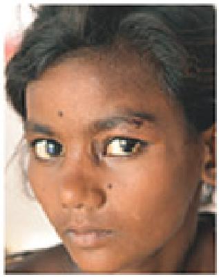 Begging for begging | भीक मागितल्याने मारला झारा